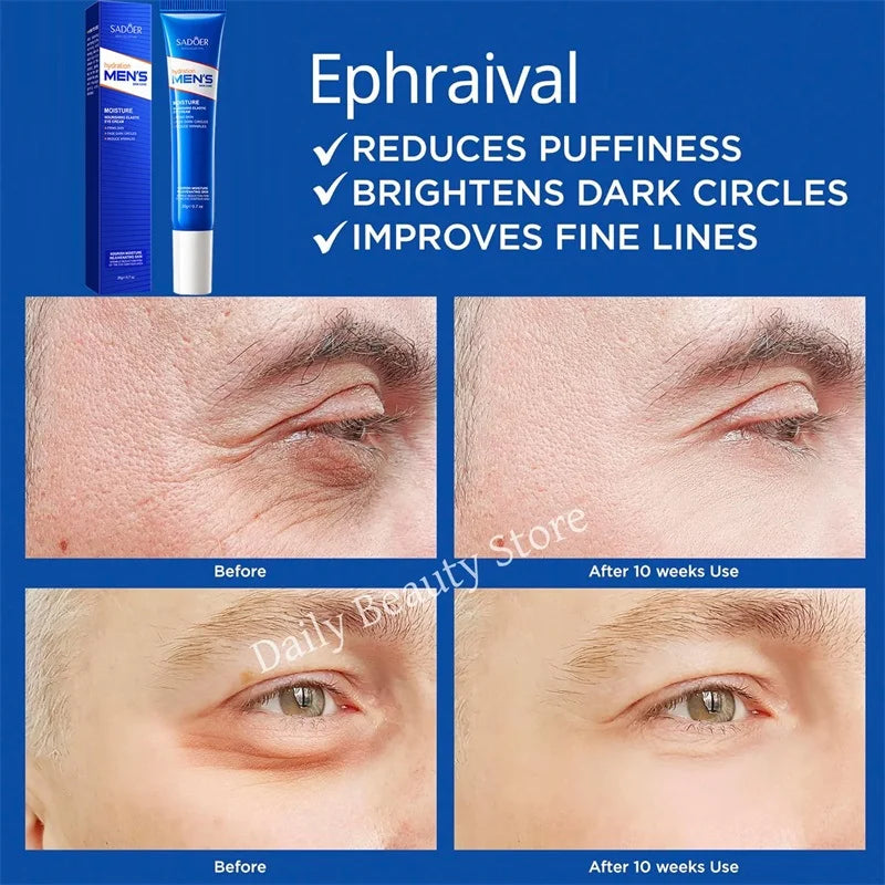 Instant Eye Cream for Dark Circles and Bags