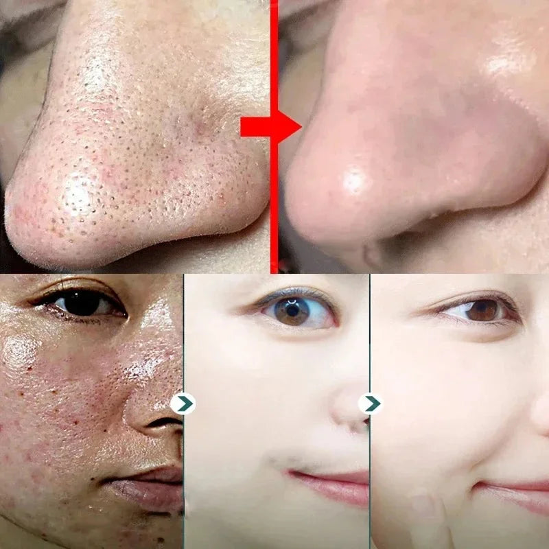 Green Tea Stick Mask – Removes Blackheads and Treats Acne