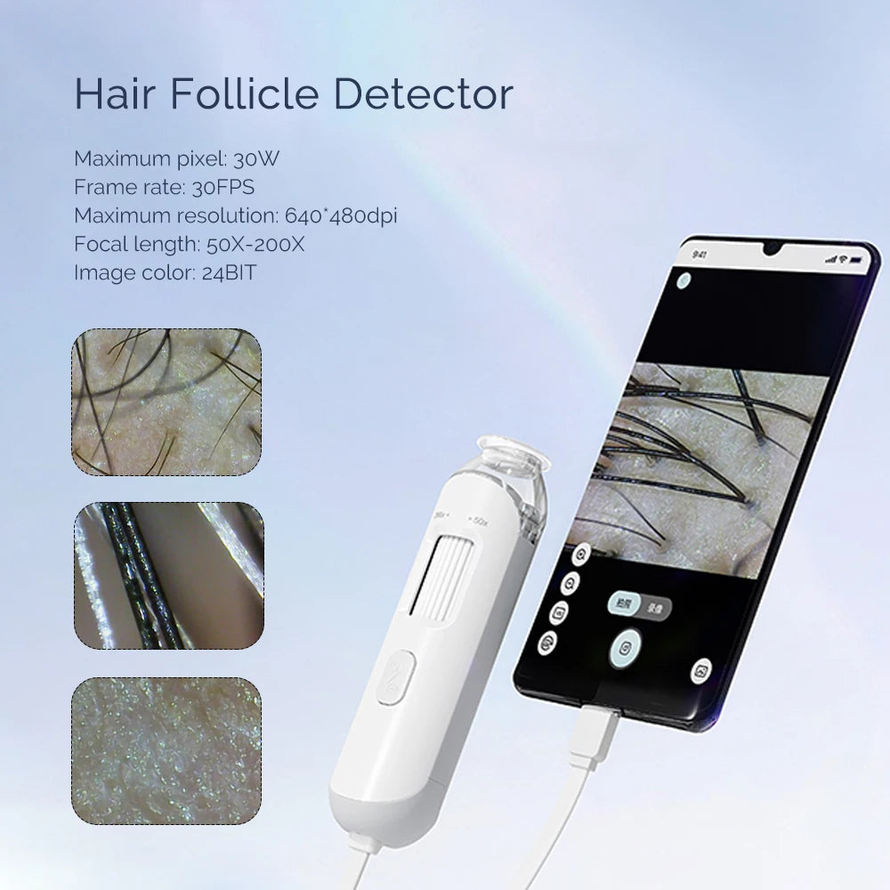 50X/200X Hair Detector – Scalp and Skin Analyzer