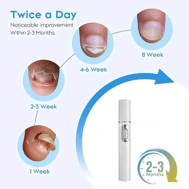 Laser Device for Nail Fungus Treatment