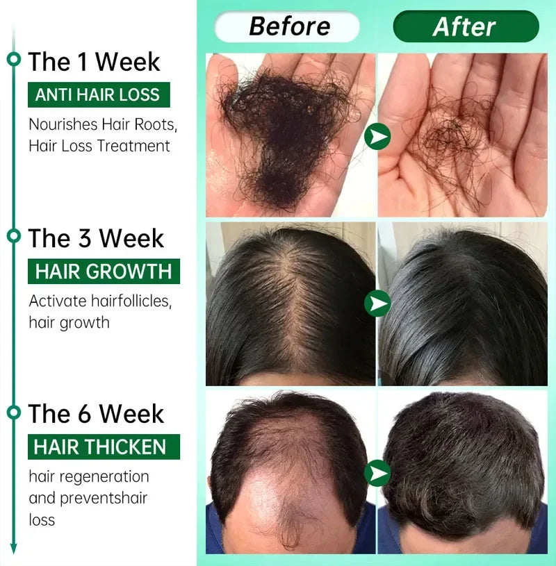 Ginger Hair Growth Serum – 7 Days