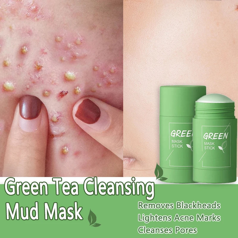 Green Tea Stick Mask – Removes Blackheads and Treats Acne