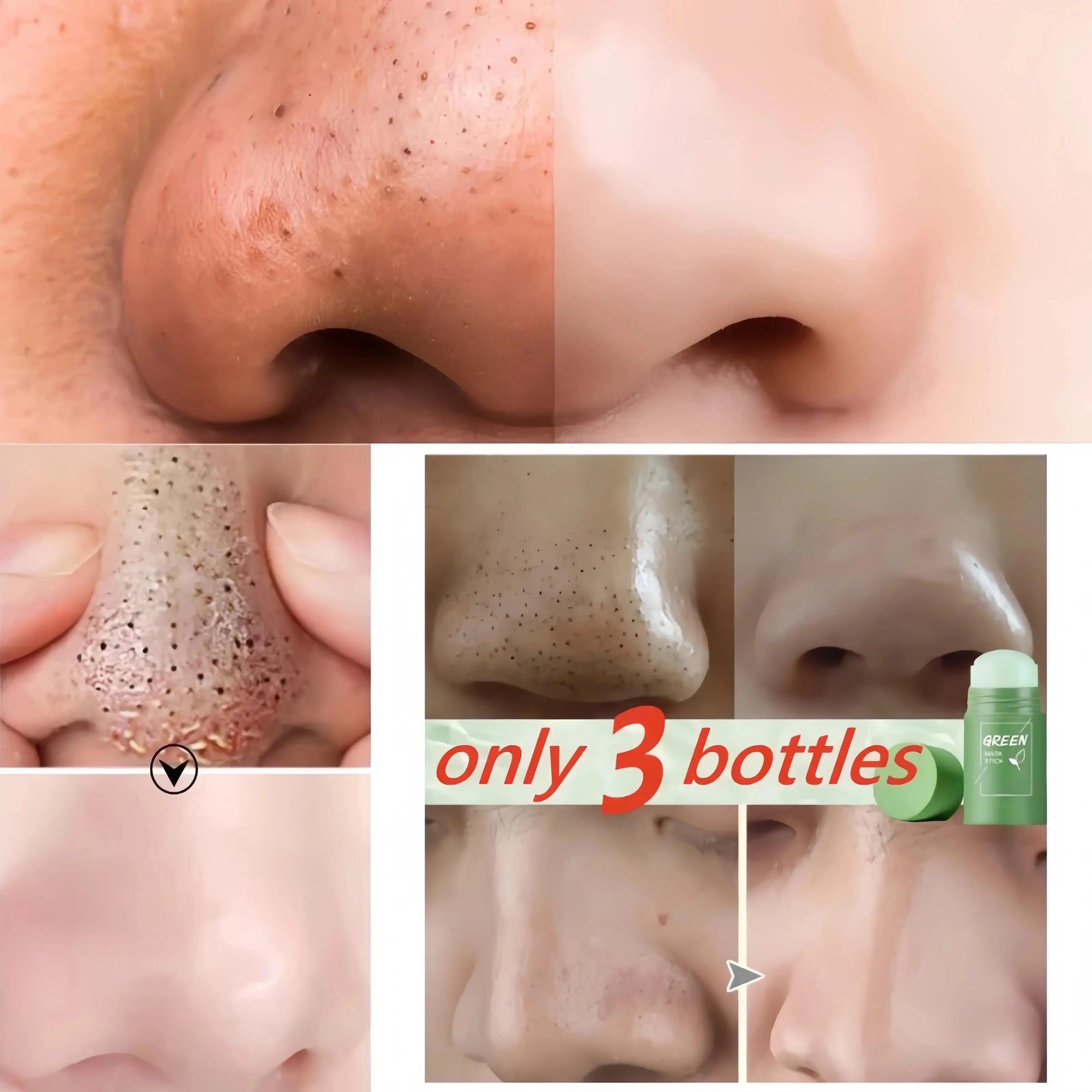 Green Tea Stick Mask – Removes Blackheads and Treats Acne