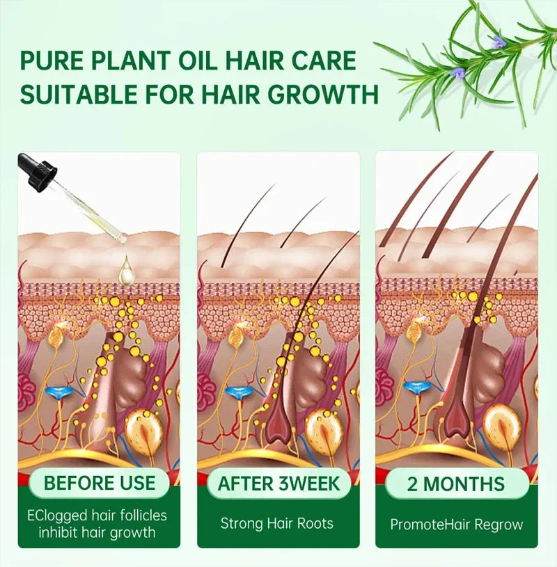 Ginger Hair Growth Serum – 7 Days
