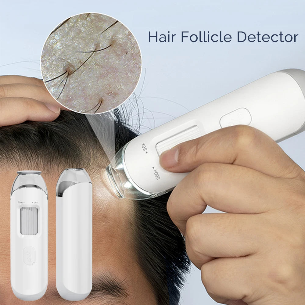 50X/200X Hair Detector – Scalp and Skin Analyzer