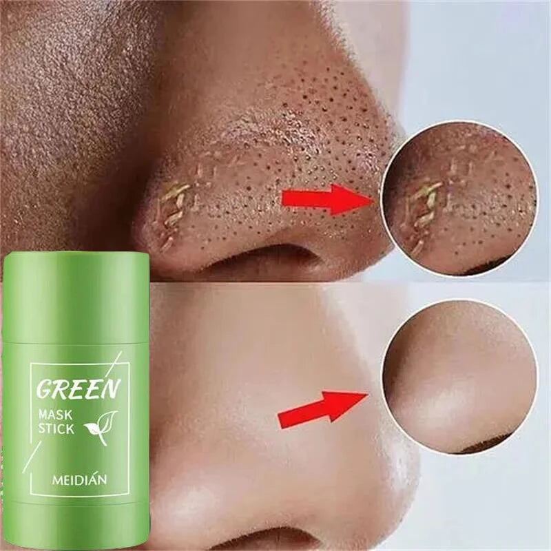 Green Tea Stick Mask – Removes Blackheads and Treats Acne