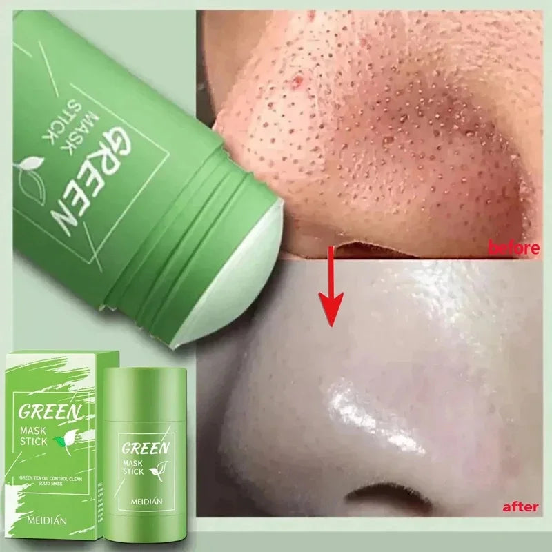 Green Tea Stick Mask – Removes Blackheads and Treats Acne