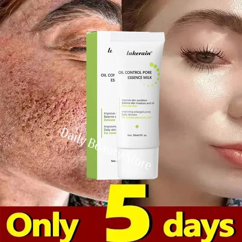 Pore-Shrinking Salicylic Acid Cream