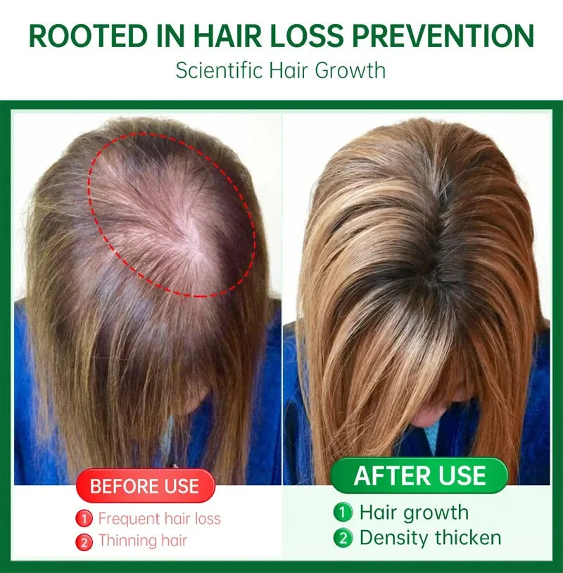 Ginger Hair Growth Serum – 7 Days
